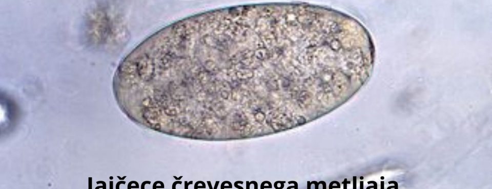 Topila po dr. Clark – jajčece črevesnega metljaja pod mikroskopom – Zapper Zaper Zaperino terapija uniči parazite