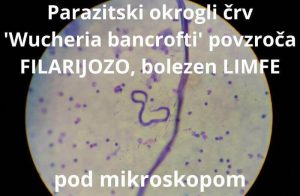 Parazitski okrogli črvi 3 vrst, ki povzročajo FILARIJOZO, Zaper Zaperino terapija dr. Clark s tinturama